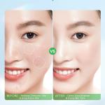 Glad2Glow Centella Salicylic Acid Exfoliating Toner Pad Clear Acne Patch Pimple Scars Soothing Skin